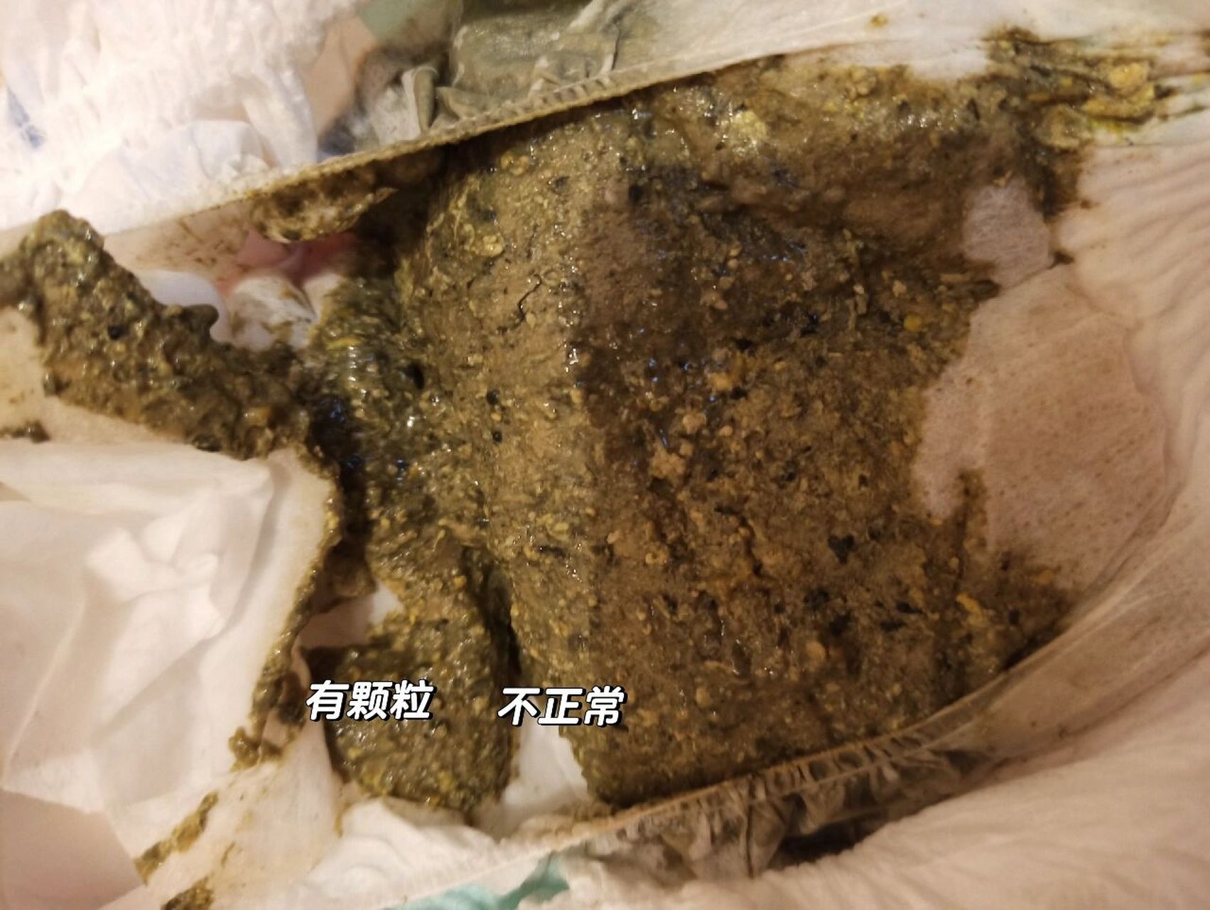 宝宝进食氨基酸配方粉初期,大便颜色有可能会有些变化,如变为黄褐色
