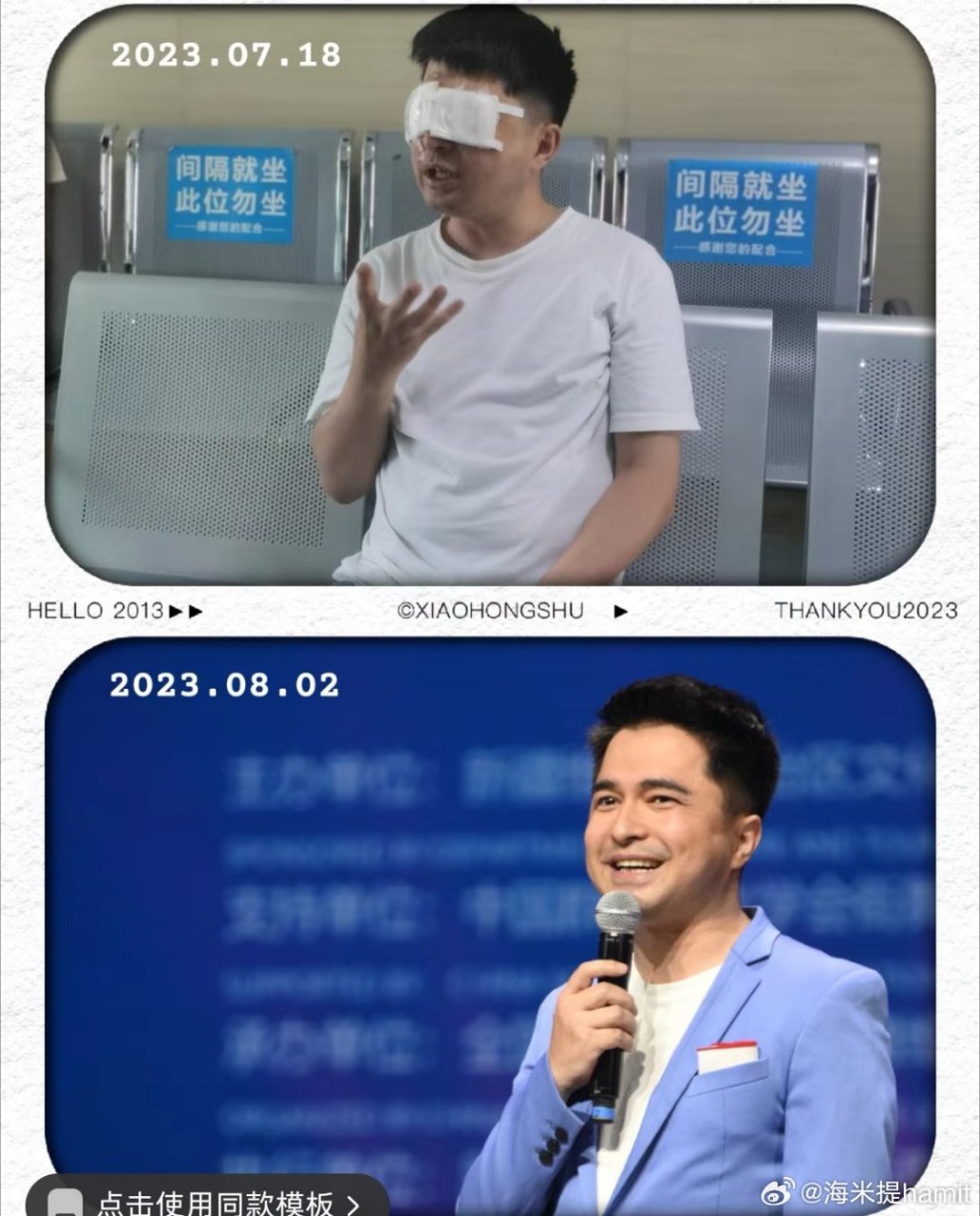 我是主持人海米提,近视对主持人这个职业来说困扰太多了,我们需要