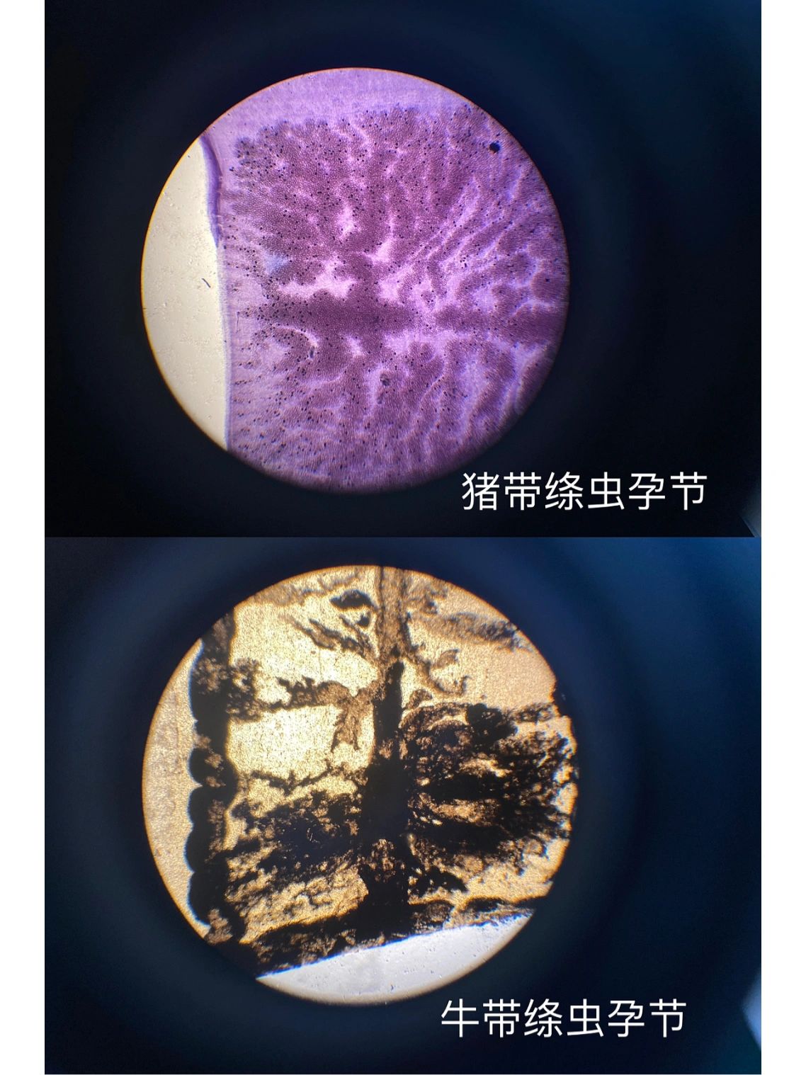19 猪带绦虫 牛带绦虫 绘图: 绦虫卵 牛带绦虫 猪带绦虫的头节和孕节
