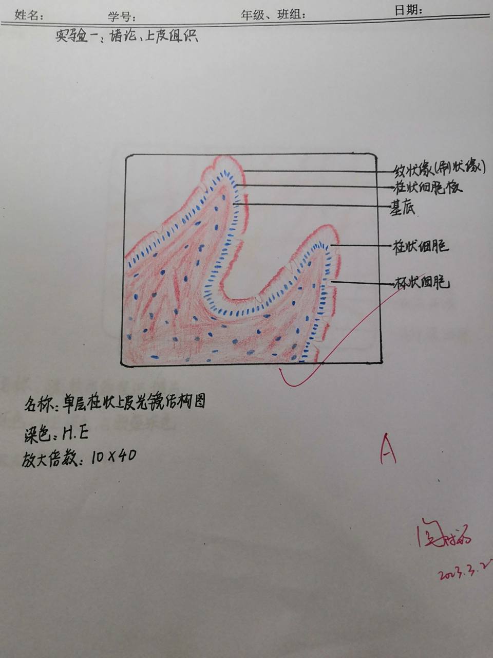 单层柱状上皮图片解析图片