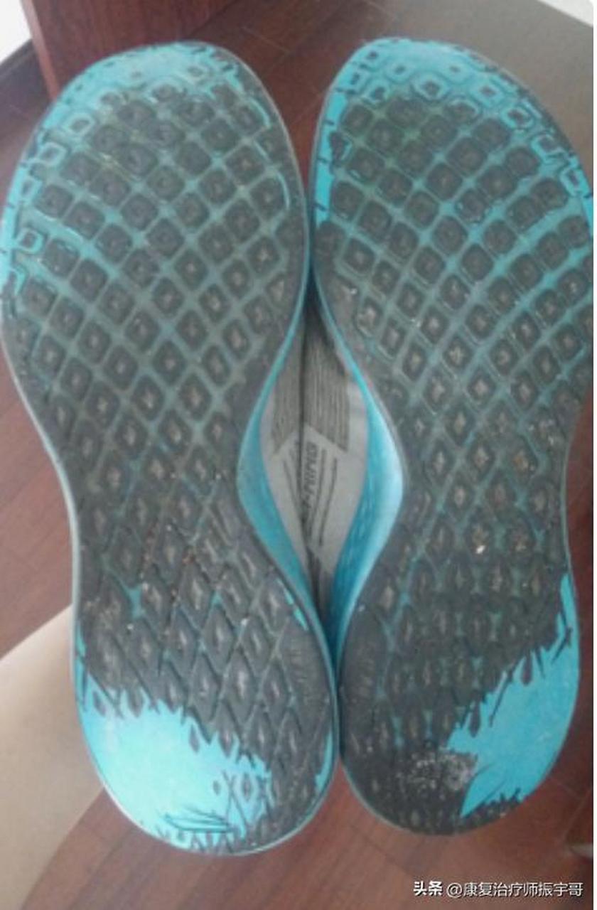 从鞋底的磨损,看足内翻和足外翻!