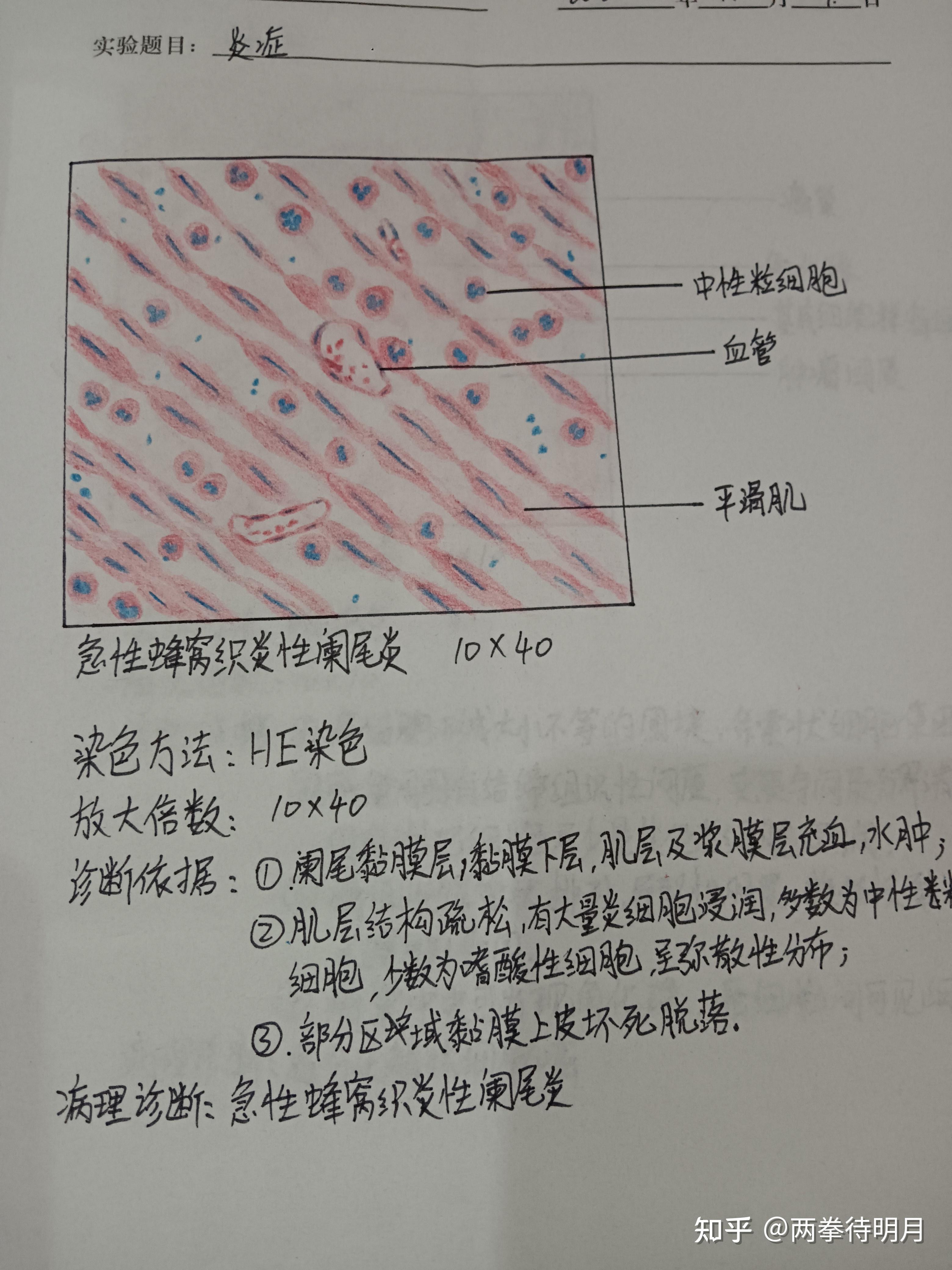 阑尾肌层图片