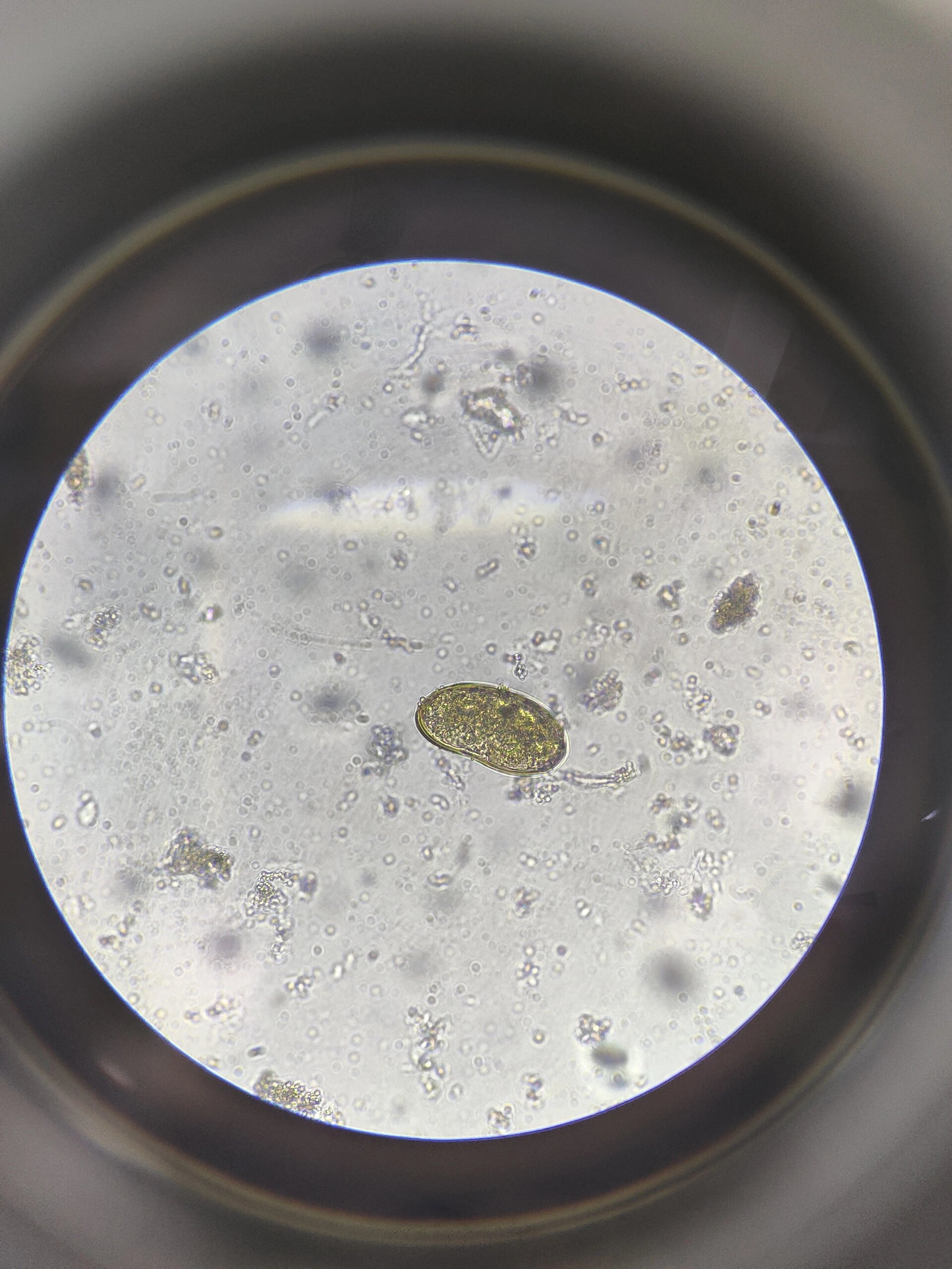 肺吸虫(卫氏并殖吸虫