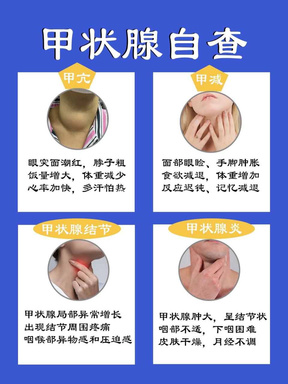 普通人也能轻松判断甲状腺问题 甲亢的症状表现 甲状腺激素过多,身体