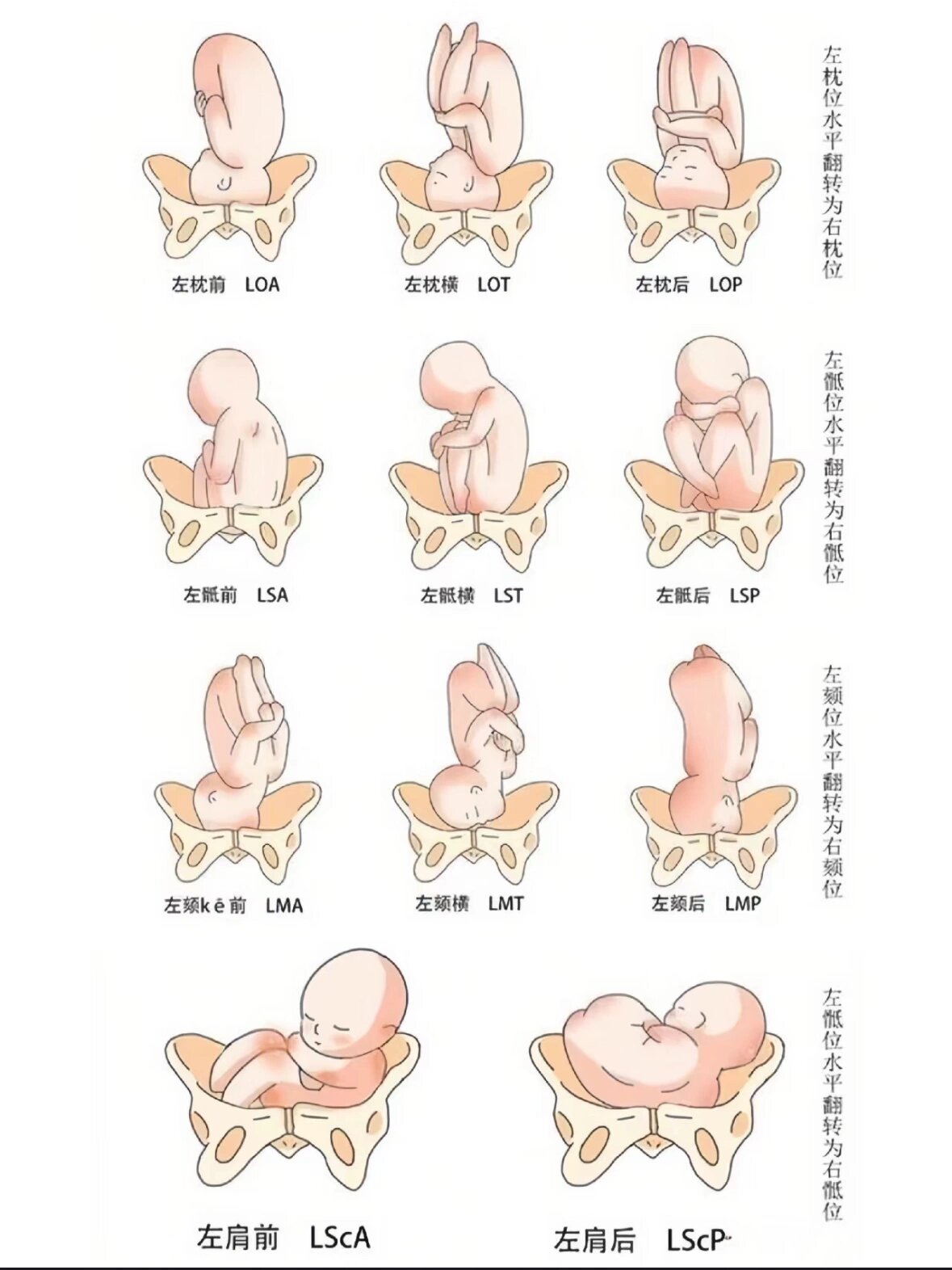 整个孕期我的崽子胎位一直在变,孕晚期一直在绕颈 大排畸23 3:roa,无