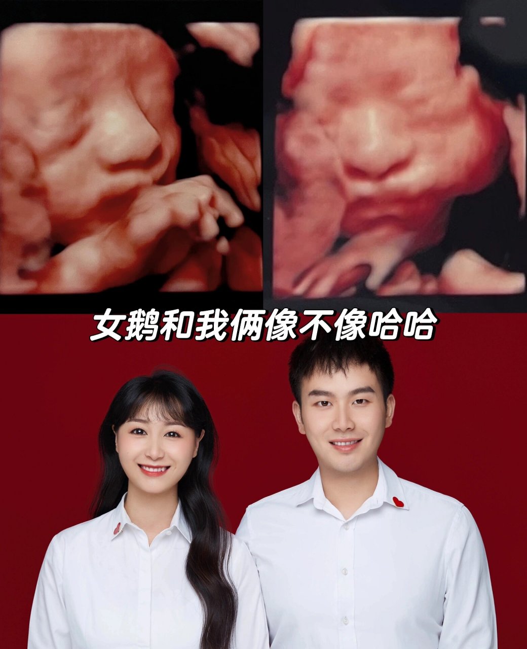 看看你们的四维彩超照片! 98救命为啥我女儿鼻子这么大啊啊啊啊!