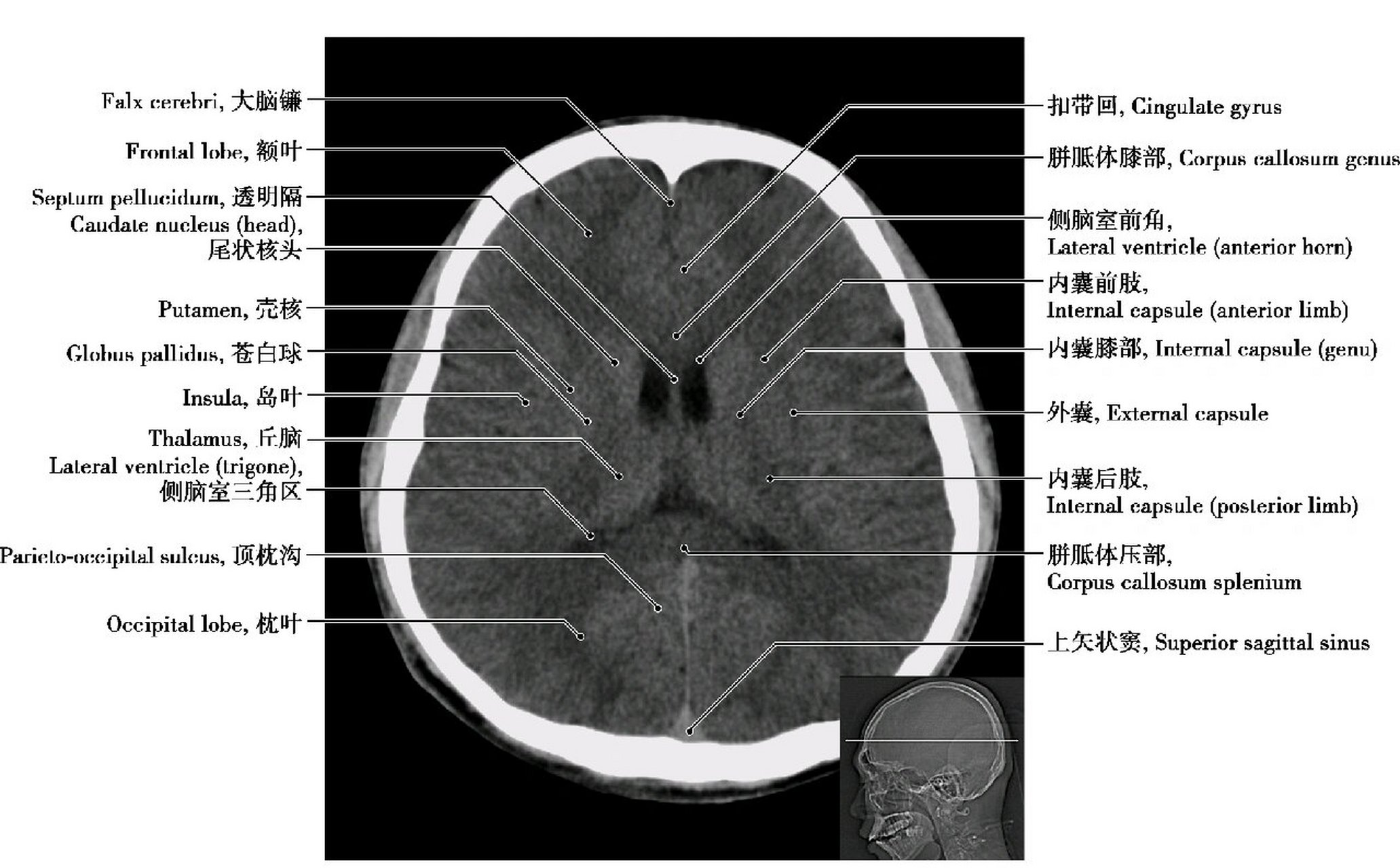 环状软骨ct解剖图图片