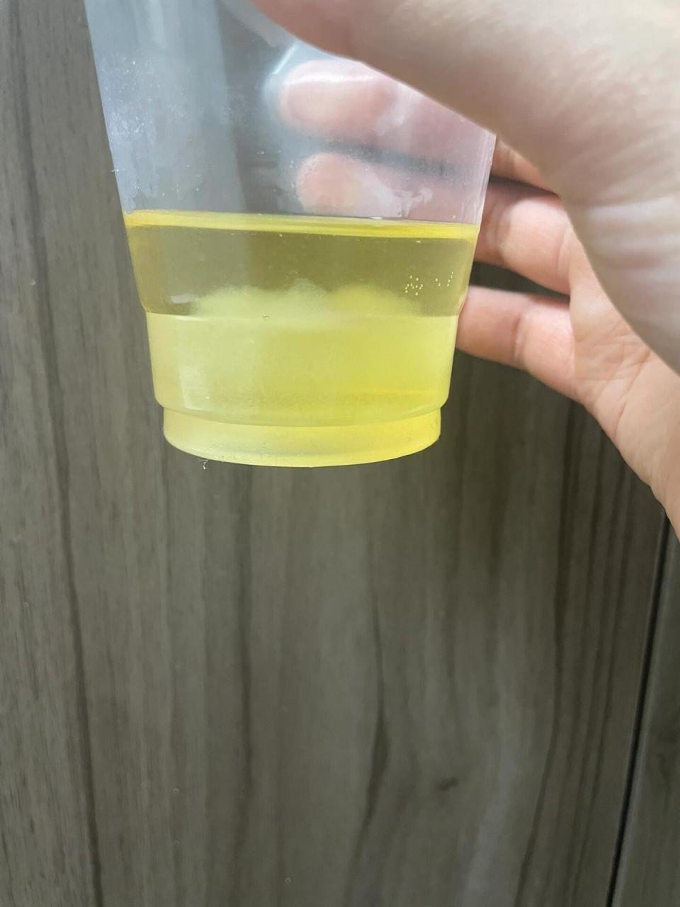 酒精测男女 是男宝还是女宝?