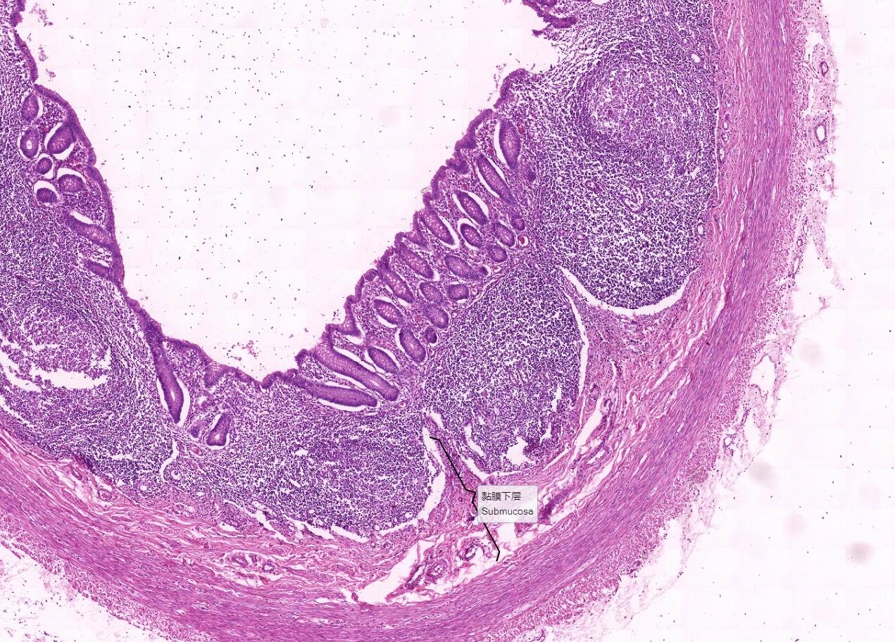 阑尾切片结构图片