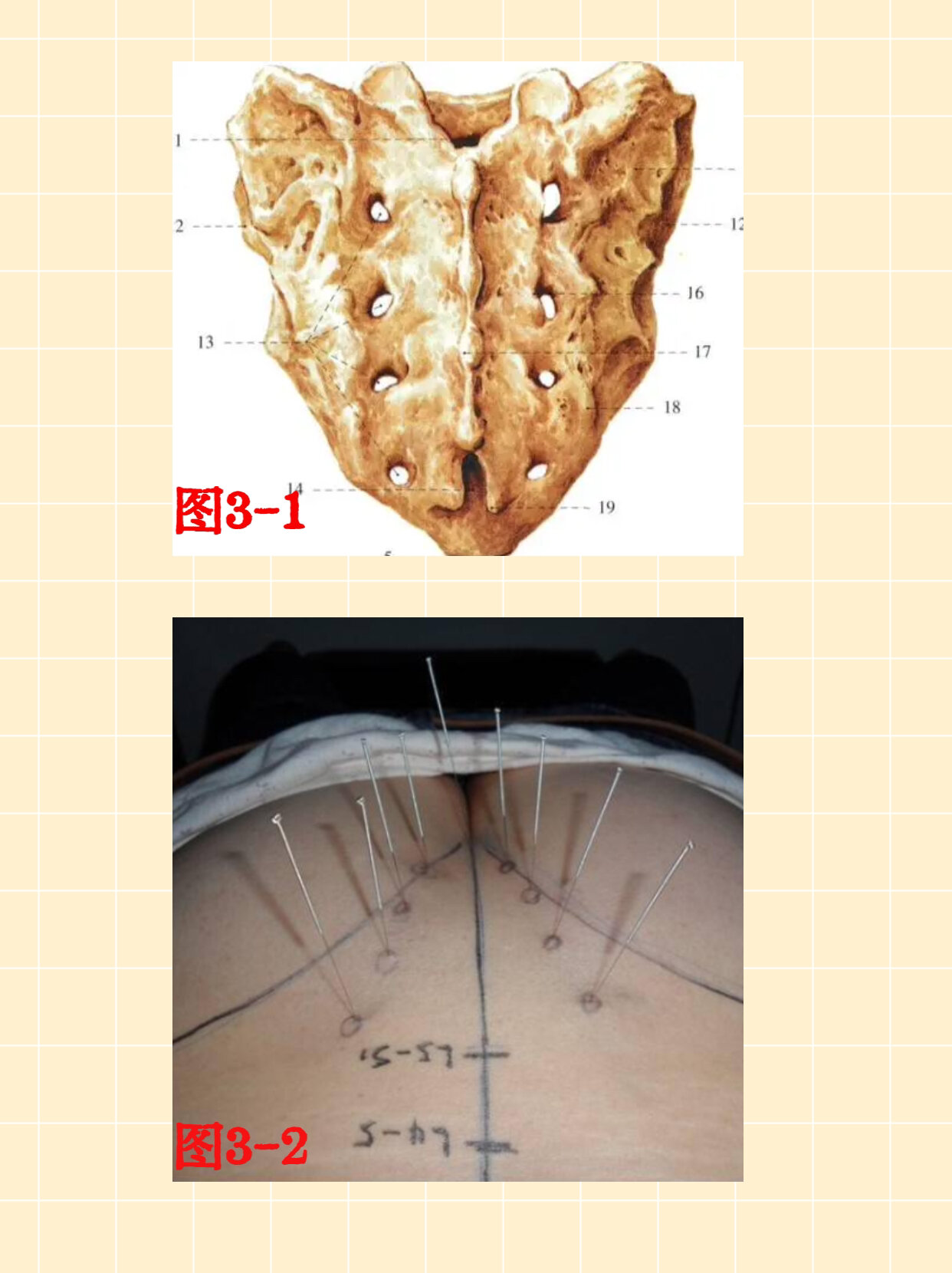 八髎 男性图片