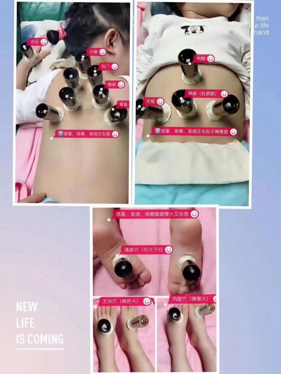 感冒,咳嗽,发烧这样用艾艾贴艾灸器或艾灸精华贴,效果很不错哒