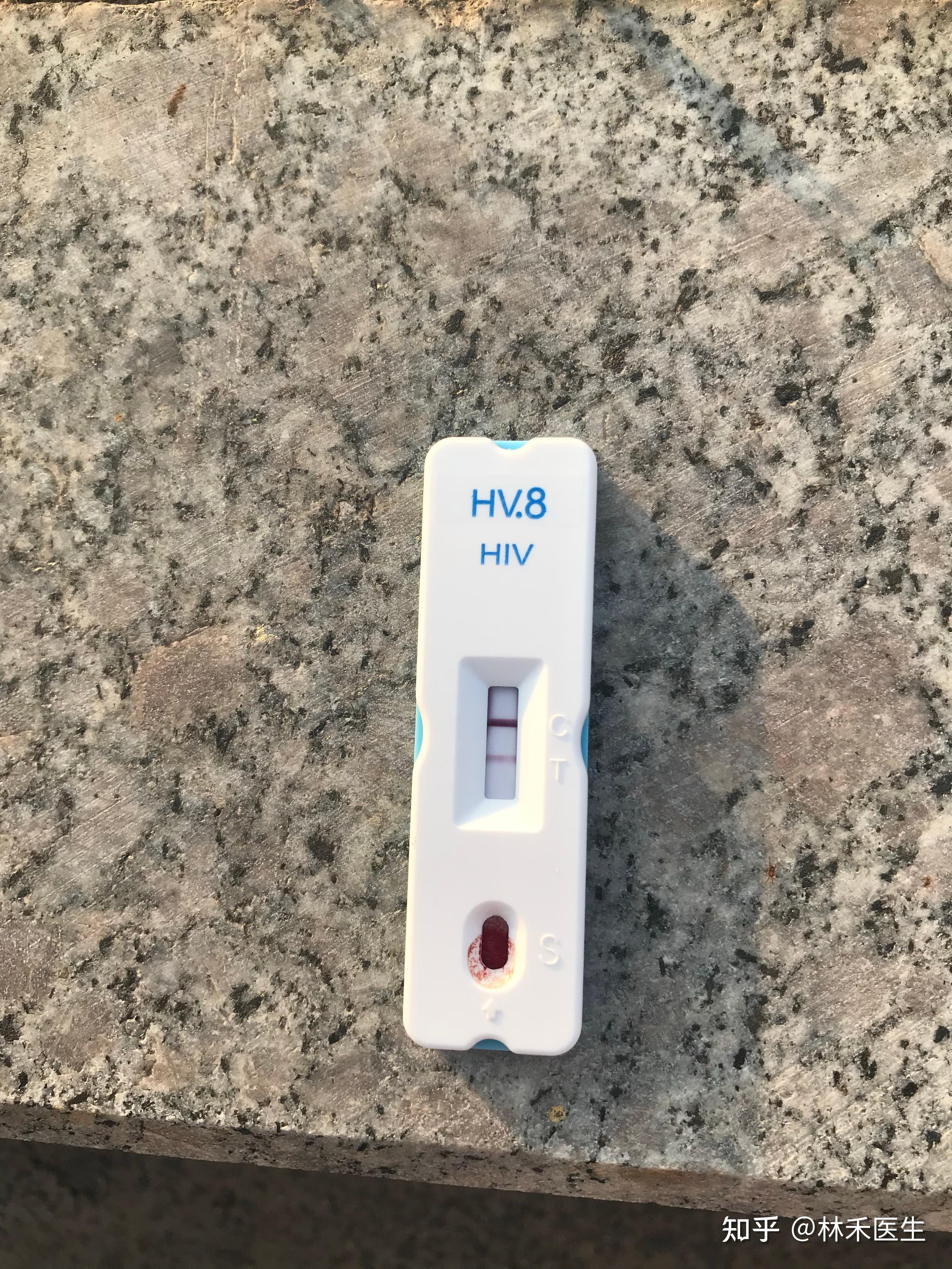 hiv试纸上有病毒吗会传染不伤口接触到了怎么办