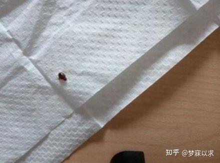 床上吸血臭虫是怎么引起的怎么判断床上有褥虫