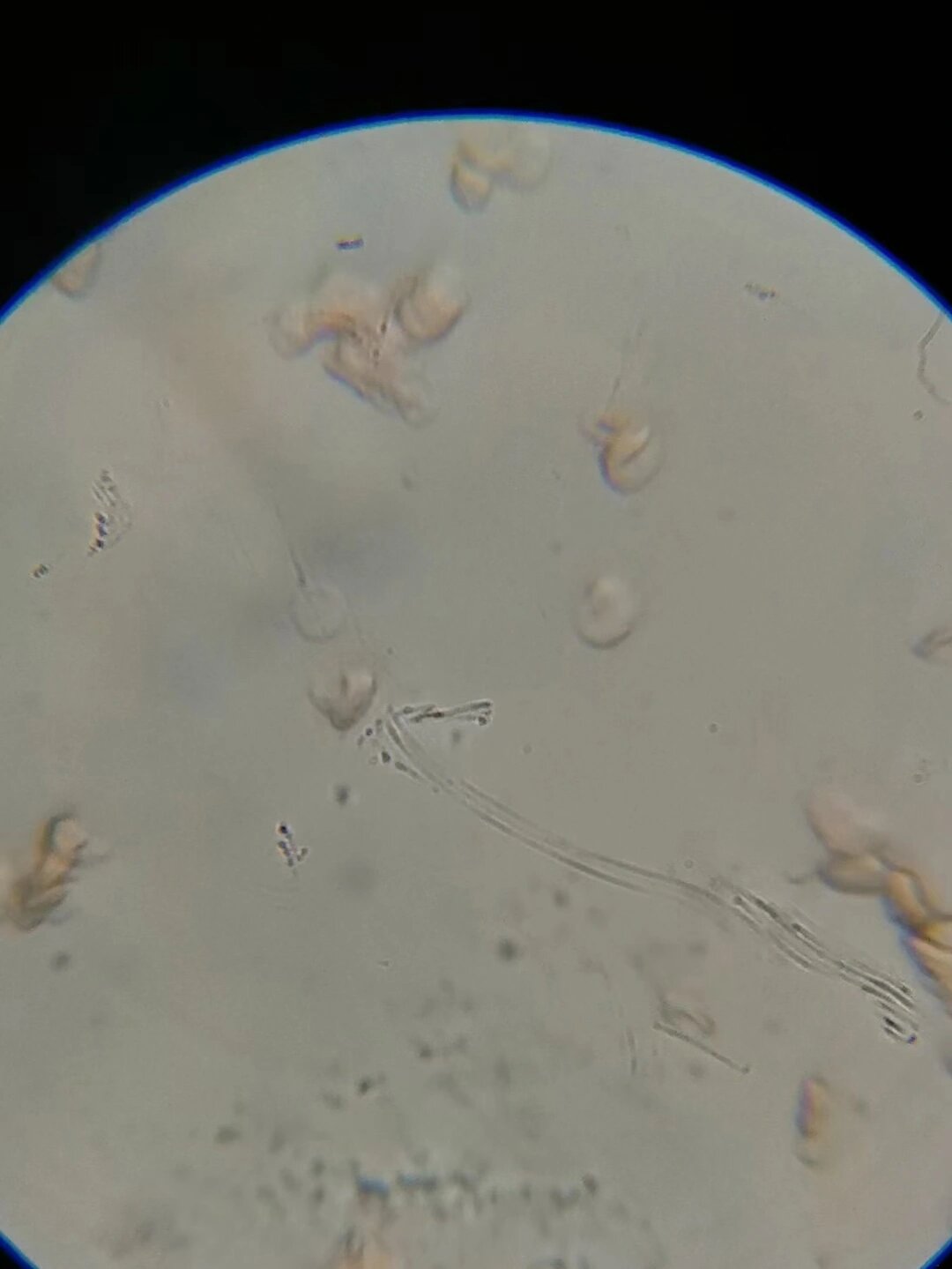 红细胞吸水涨破