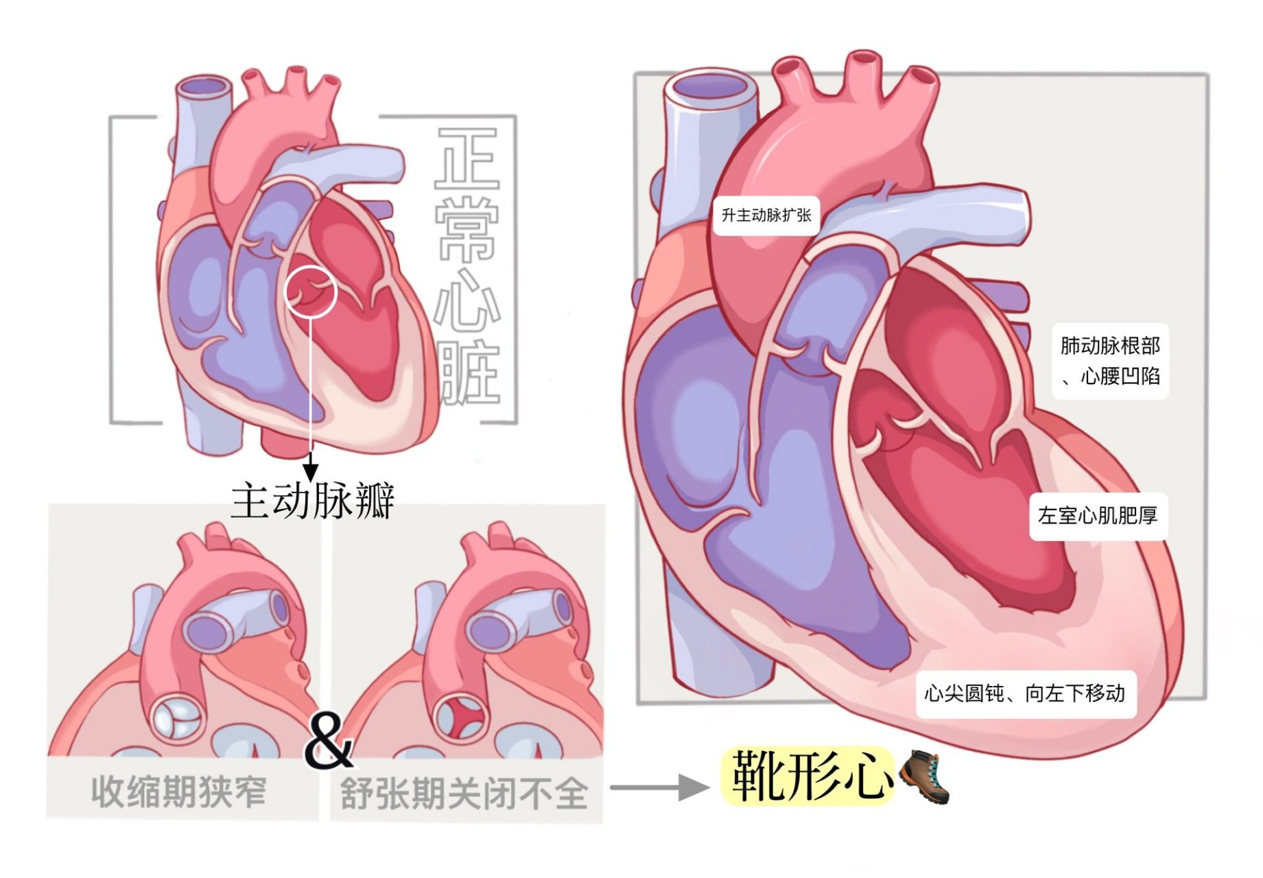 医学生画图笔记