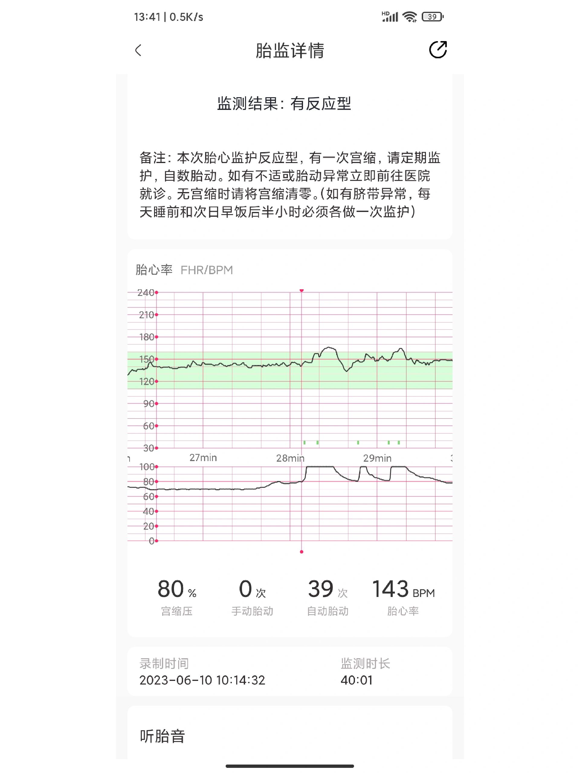 胎心监护看宫缩图解图片