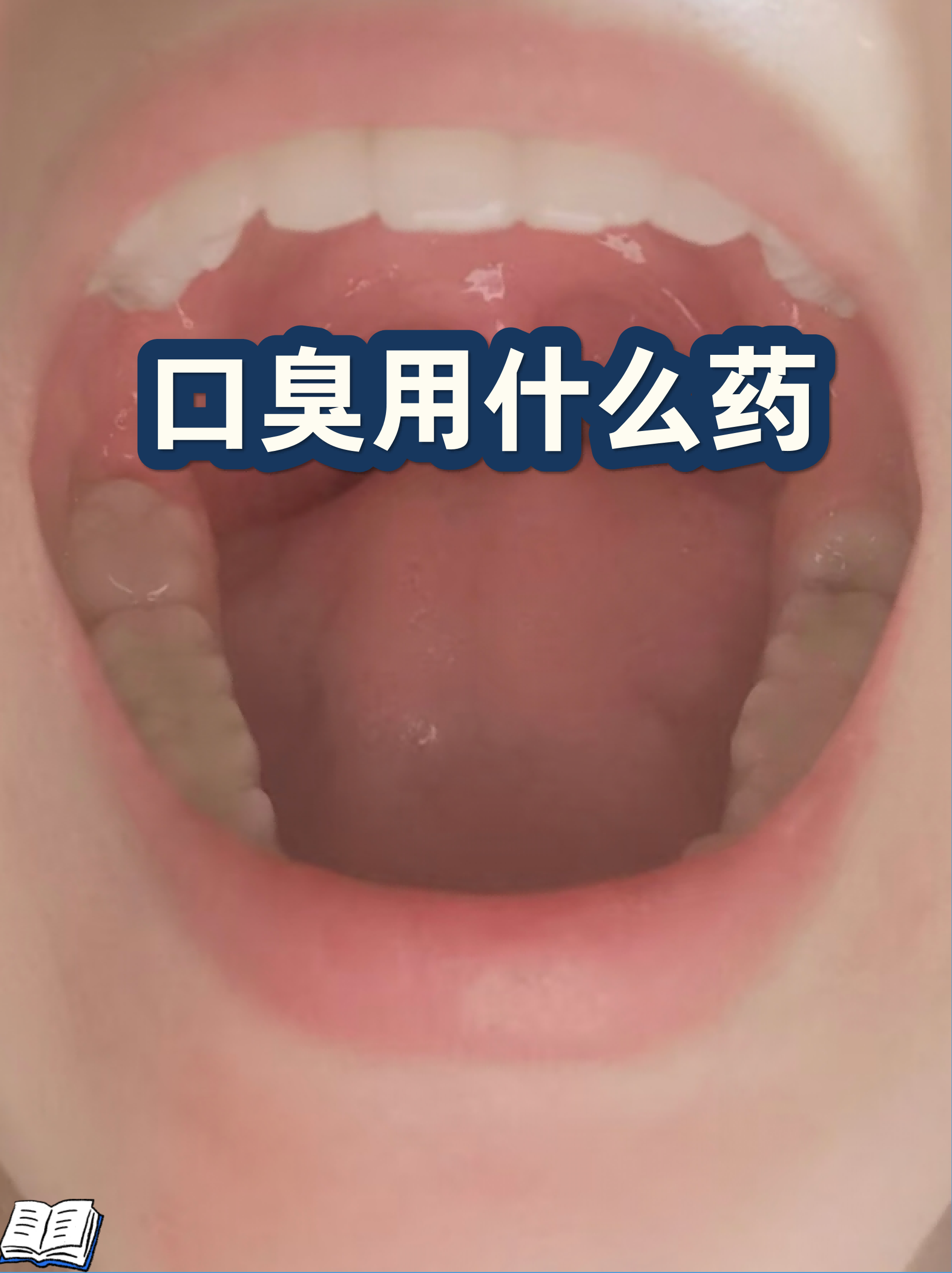 关于原空军总医院检查陪护加挂号突发状况第一时间响应，不耽误病情的信息