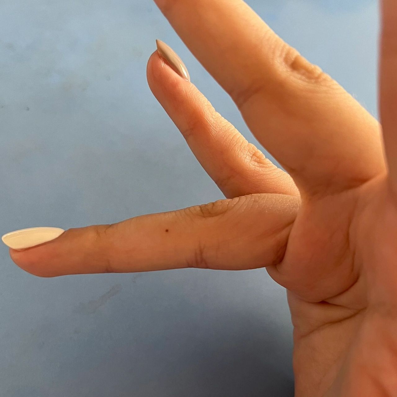 昨天洗完澡发现手指上有个脏脏的黑点,还以为是什么脏东西,扣了半天