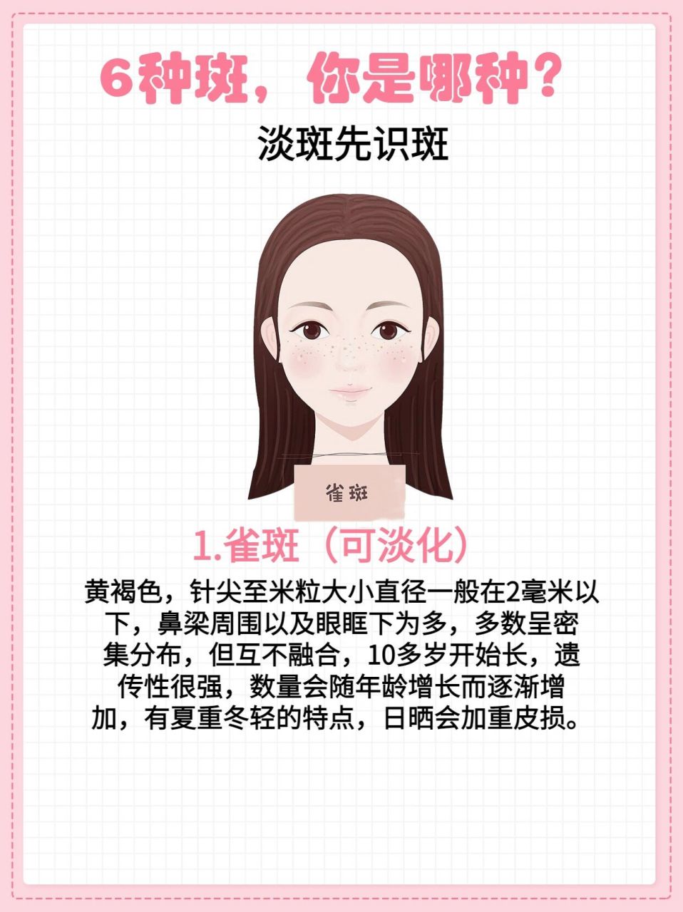 97雀斑,晒斑,老年 不同的斑看似相同,实则各有不同,今天来一一拆解