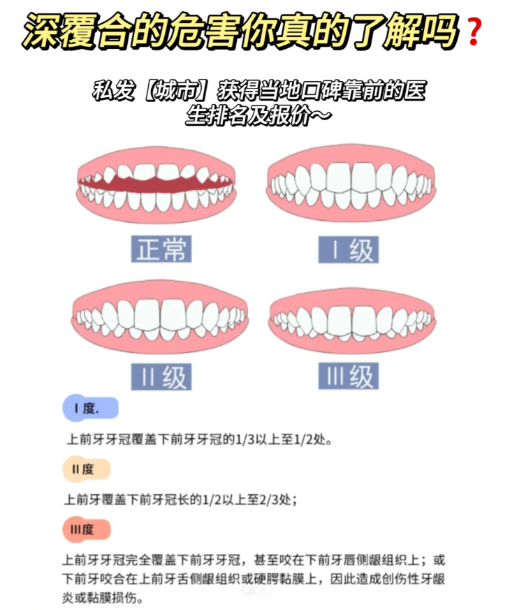 牙齿深覆合面相图片