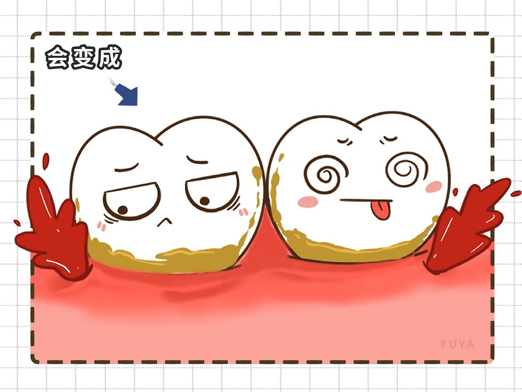 你知道牙结石是怎么生成的吗? 口腔内,可是存在着许多细菌呢!