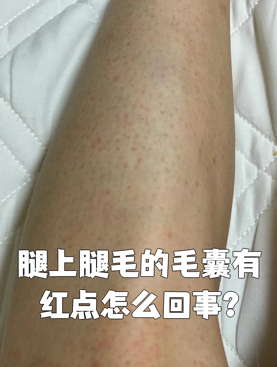这两种情况需要不同的处理方法