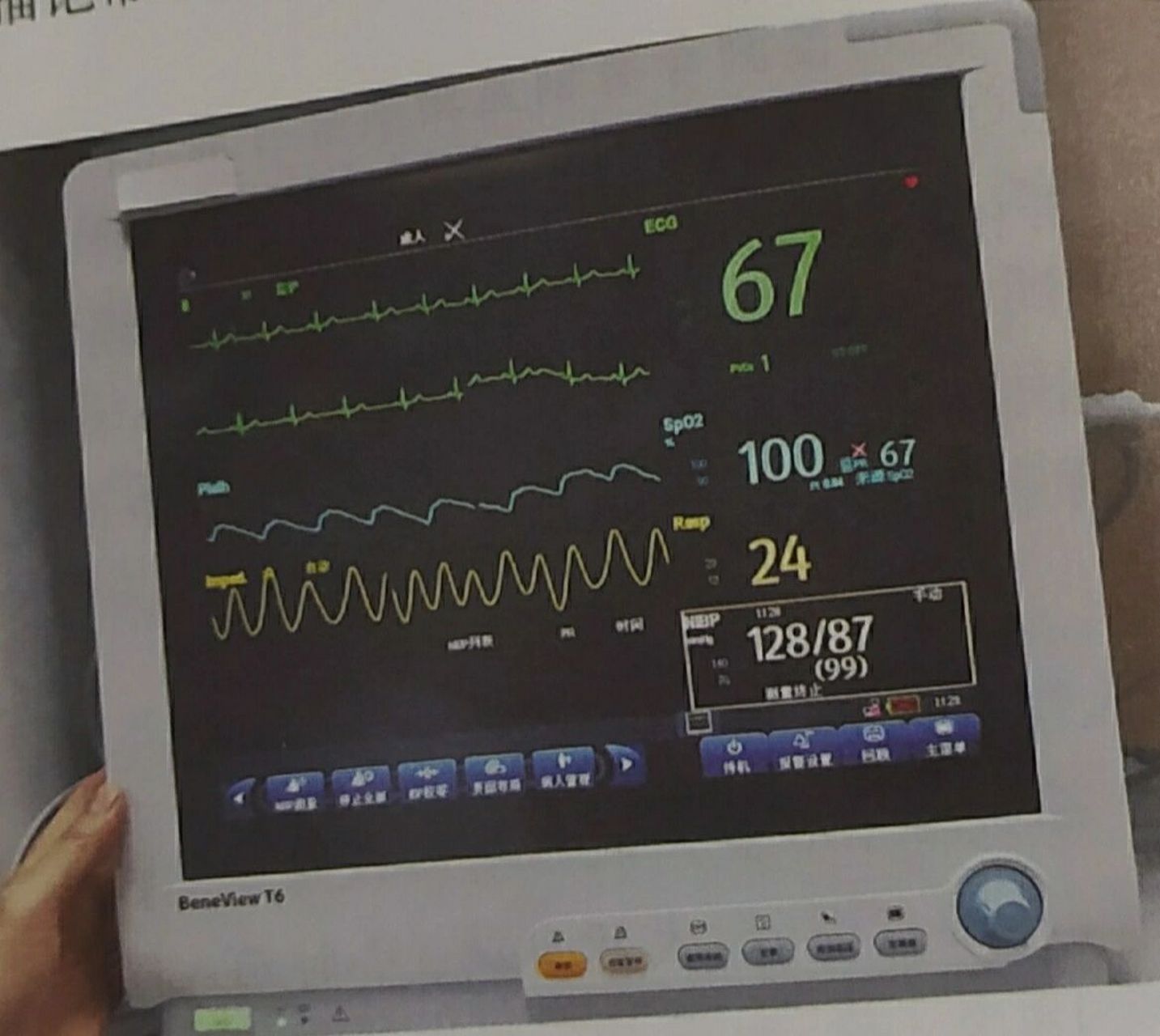 临床必备:心电监护仪的使用