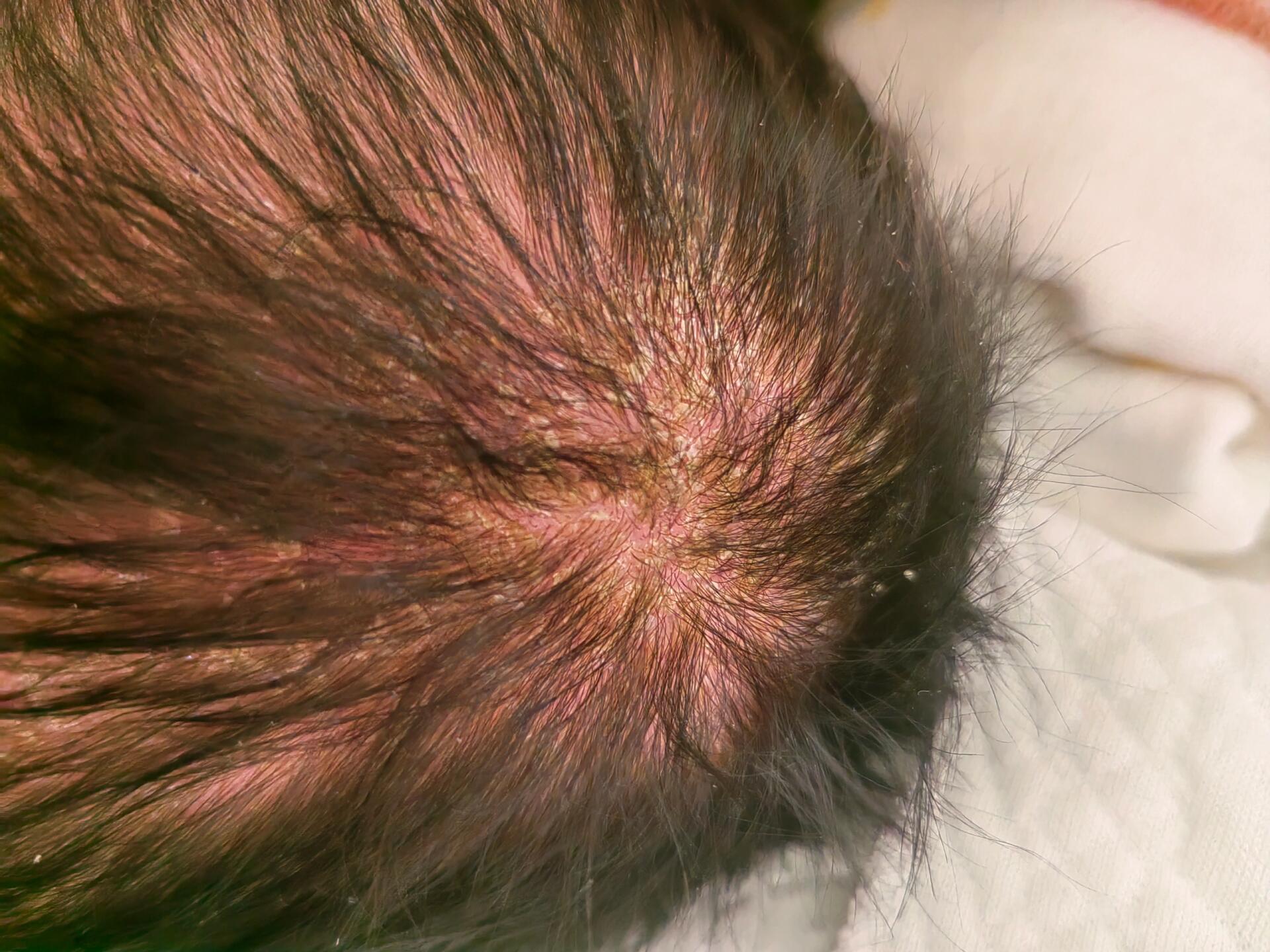 宝宝头上黄色结痂怎么办?其实清理很简单!