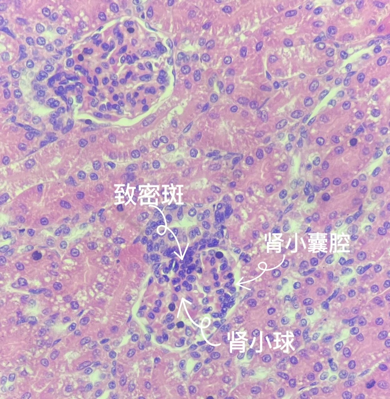 肾脏冠状切面结构图图片