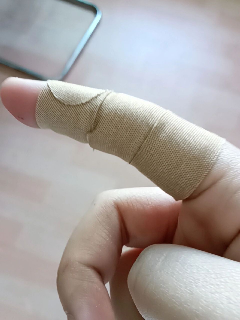 被金丝熊咬了不打针行吗 已经拿肥皂洗过了,然后用碘酒消毒了,我妈