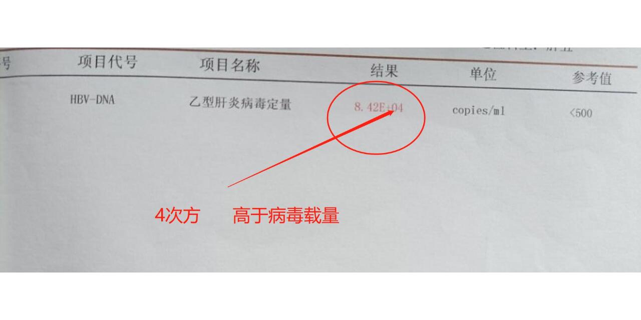 乙肝病毒定量是一种血清学检查方法,用于检测乙型肝炎病毒(hbv)dn在 