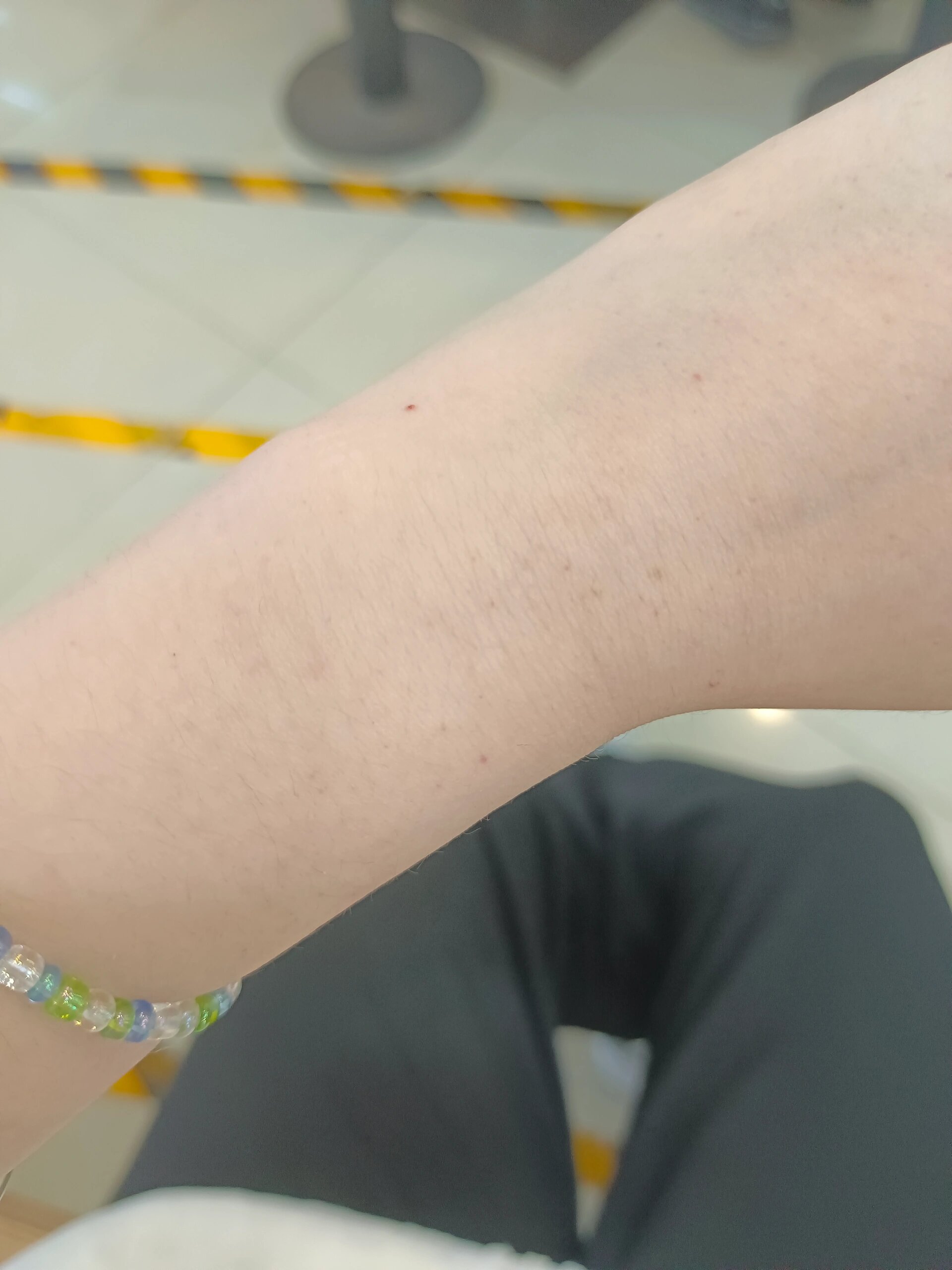 胳膊和手上突然长了好多小红点是怎么回事啊