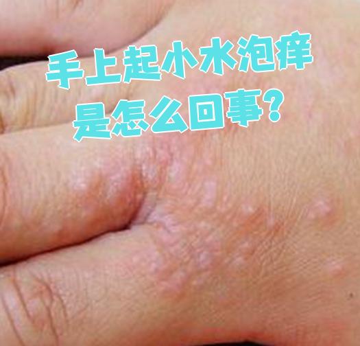手上为什么会起小水泡不痛不痒为什么在线 手上为什么会起小水泡不痛不痒为什么在线