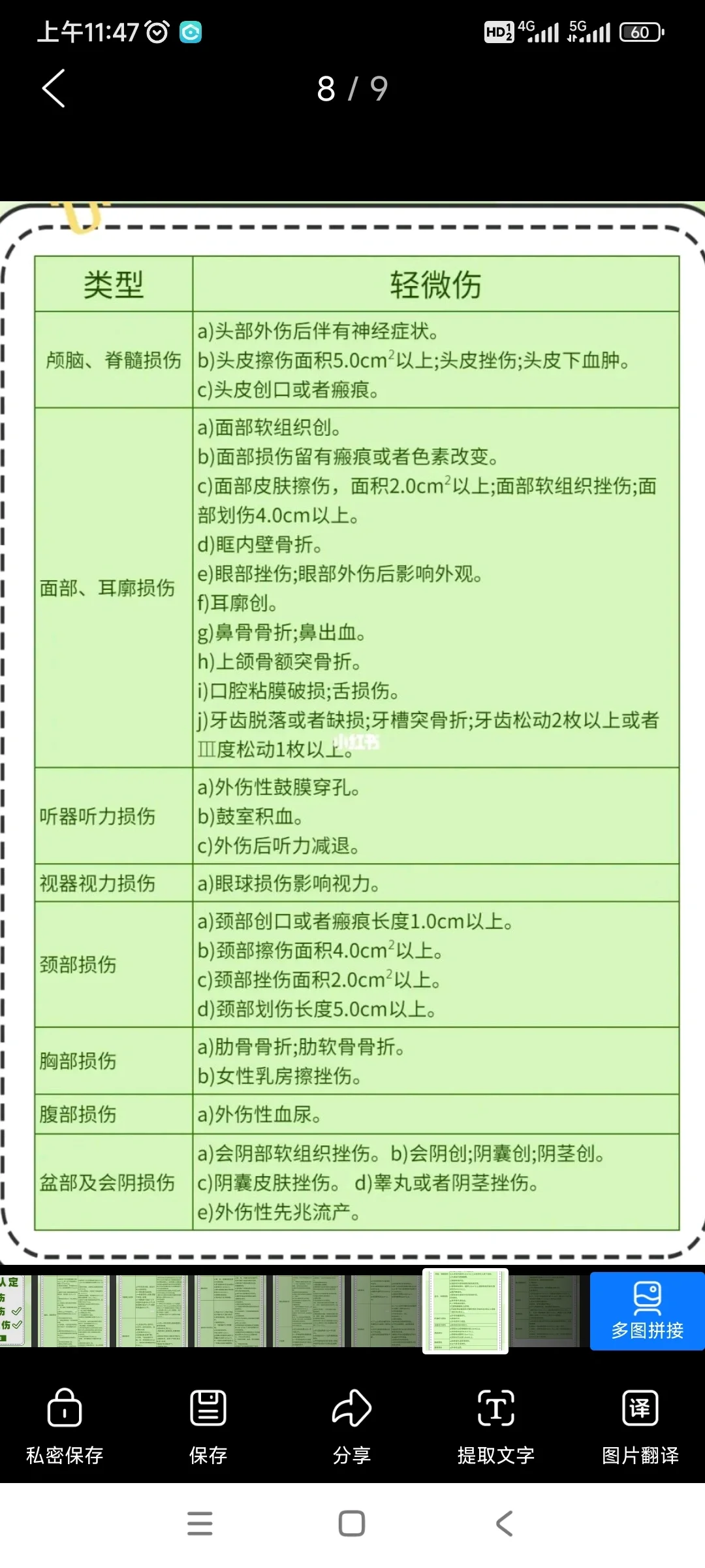 伤情鉴定不算轻微伤,现在还没看到报告,打电话问,好像说是挫伤,实际