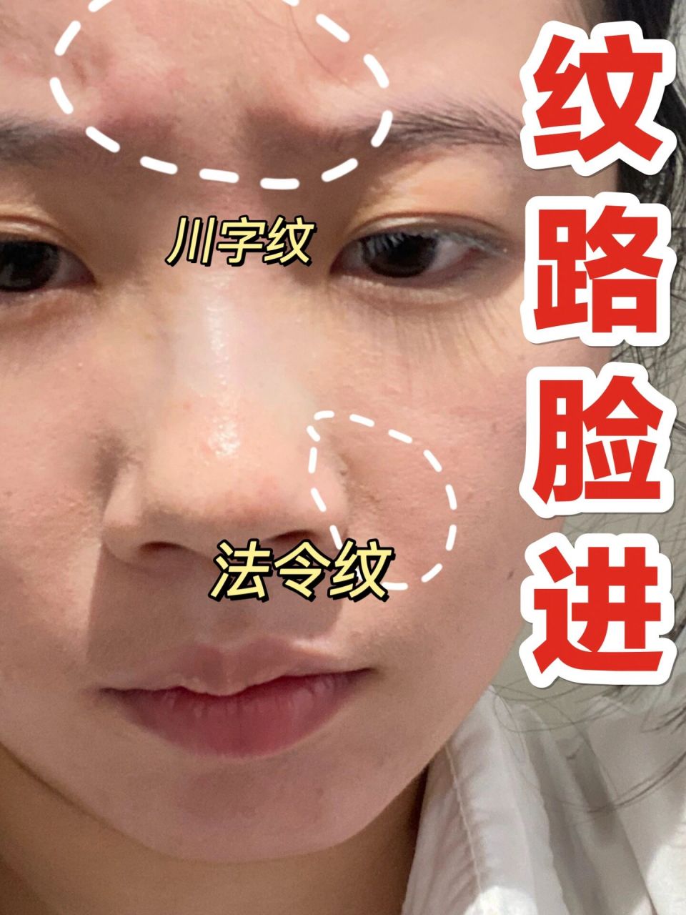 川字纹法令纹进来看!看到这篇是你们的福气! 从小就表情丰富,经常大笑