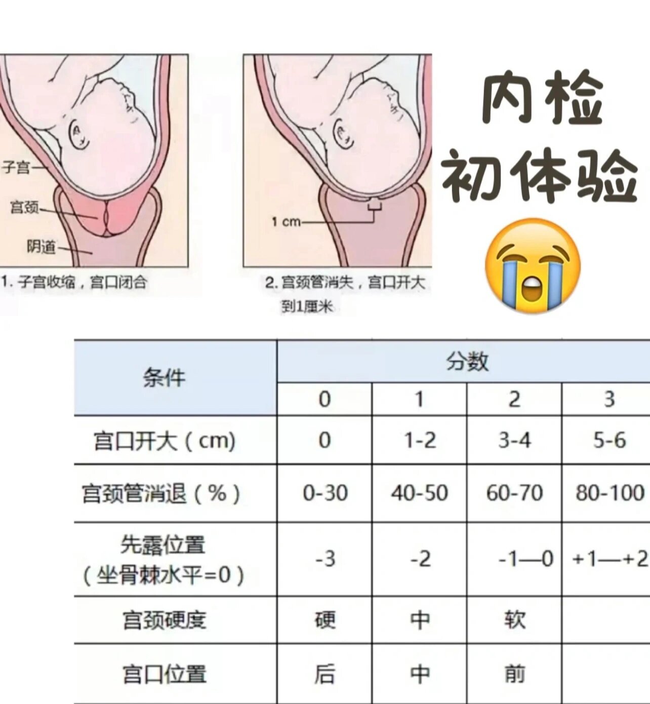 39w内检,宫颈靠后,未开口未消退,软 这样有机会顺产成功吗?