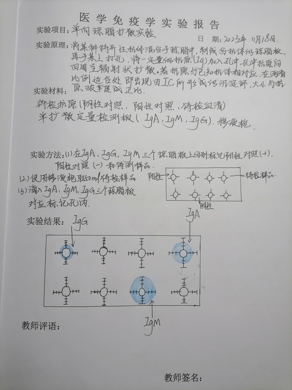 单向琼脂扩散试验图片