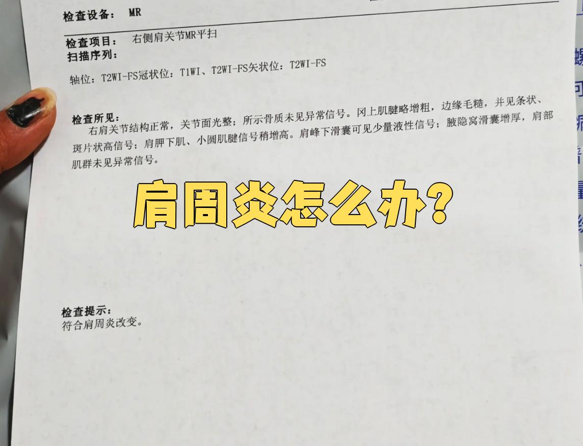 肩周炎的治疗方法主要有保守治疗和手术治疗两种,大多数情况下保守