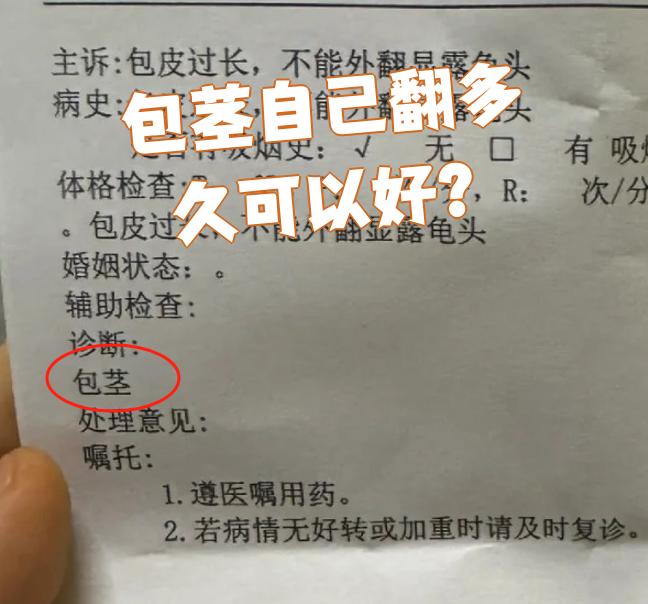 包茎能不能自己翻好要看具体情况