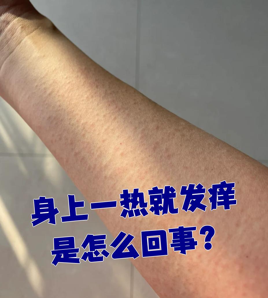 为什么身上一热就痒