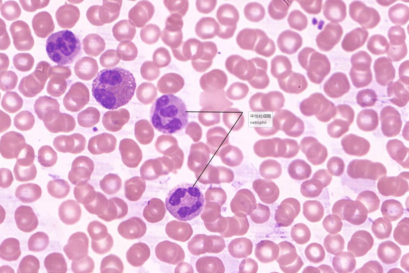 5 血液:白细胞5分类