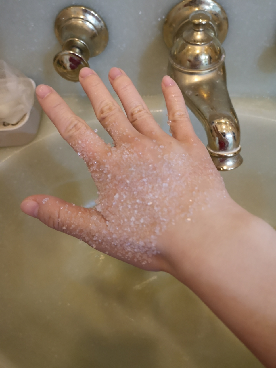 手被开水烫了怎么办?