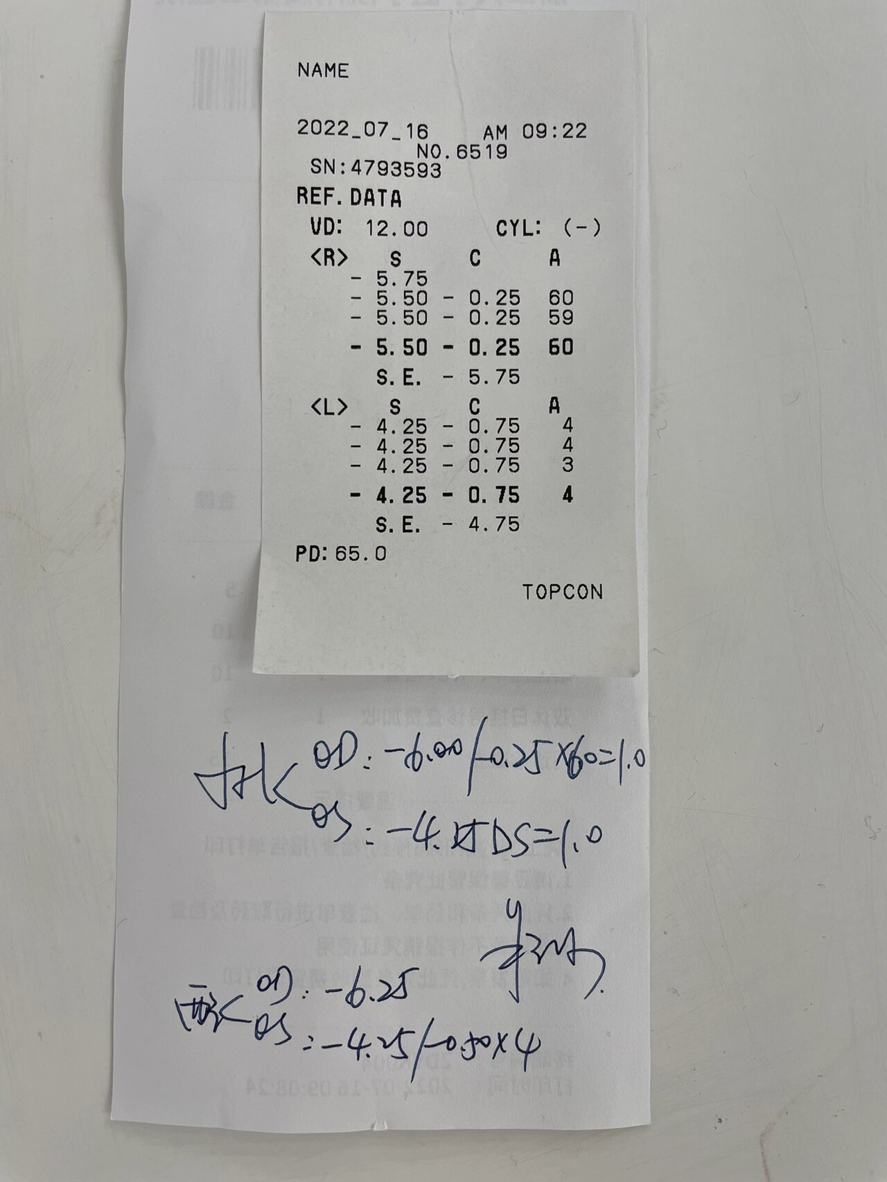 浙二眼科验光 网上配镜