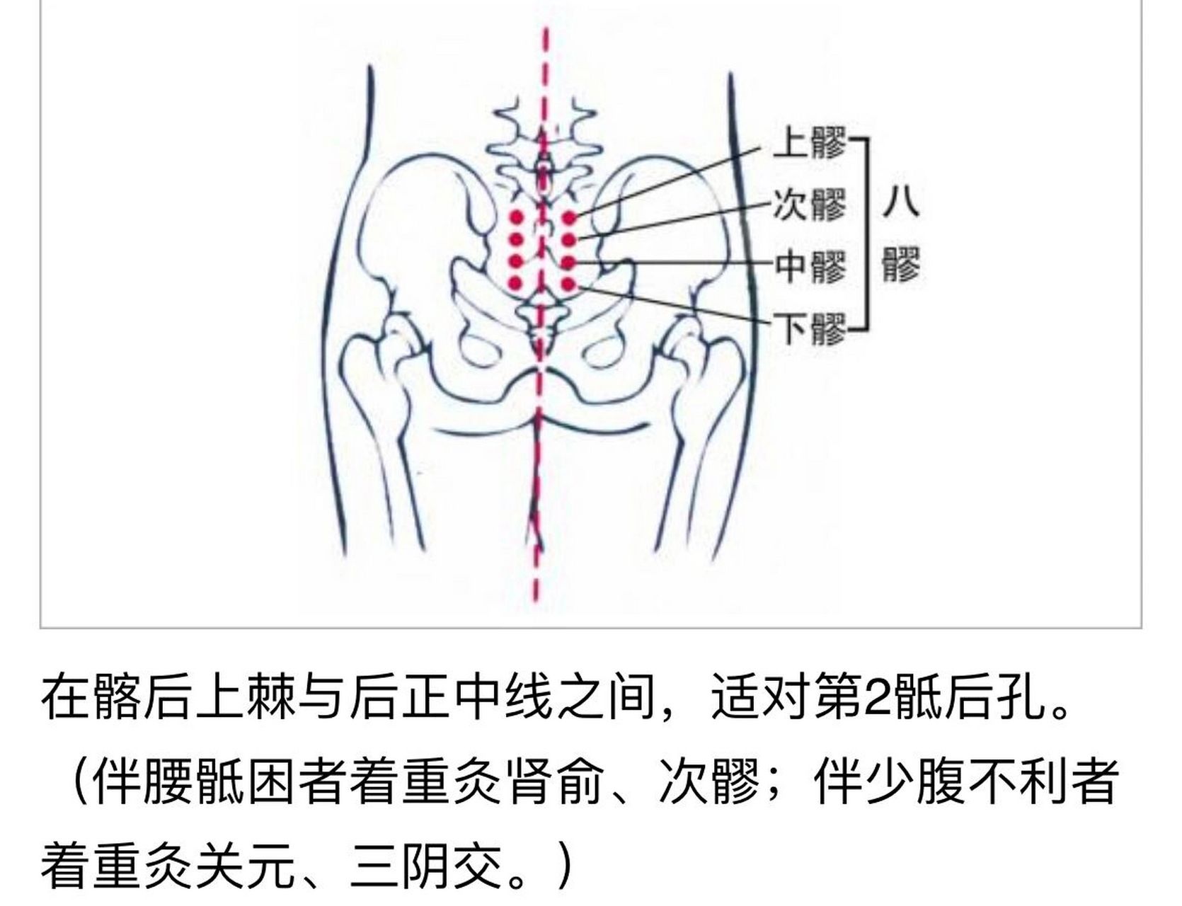 八髎的准确位置图尺寸图片