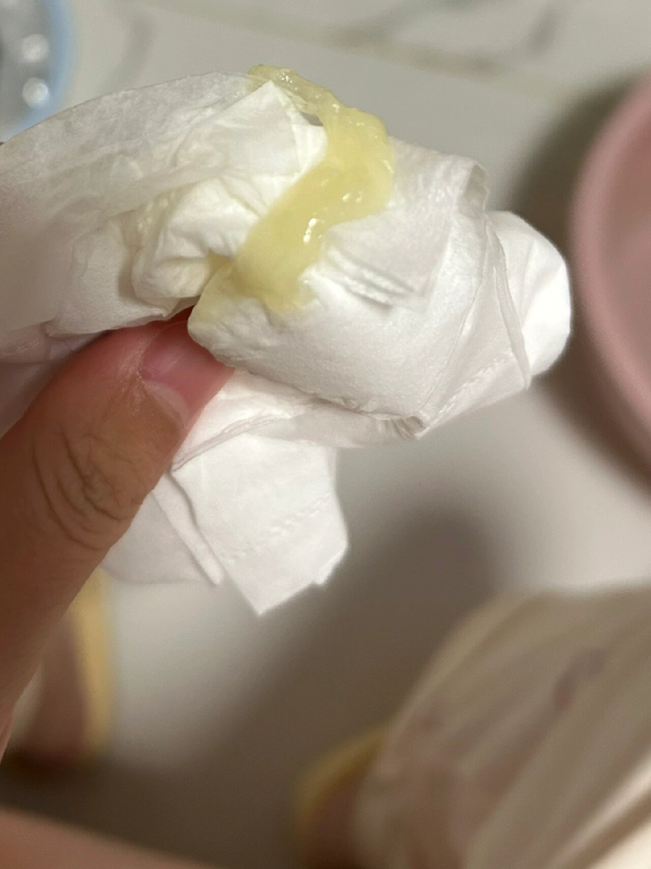 白色带有黄色分泌物正常吗为什么在线