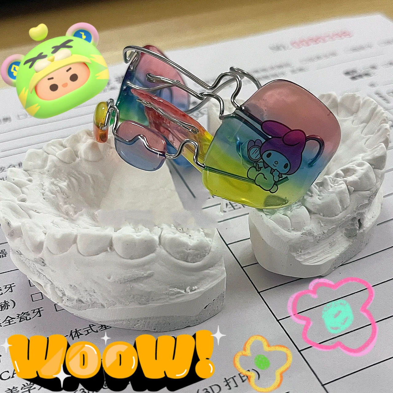 法兰克2功能矫治器frank 2❗️ 产品功能: 功能调节器.