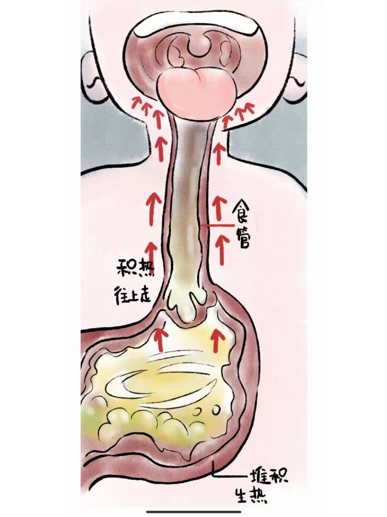 扁桃体坑坑洼洼的图片图片