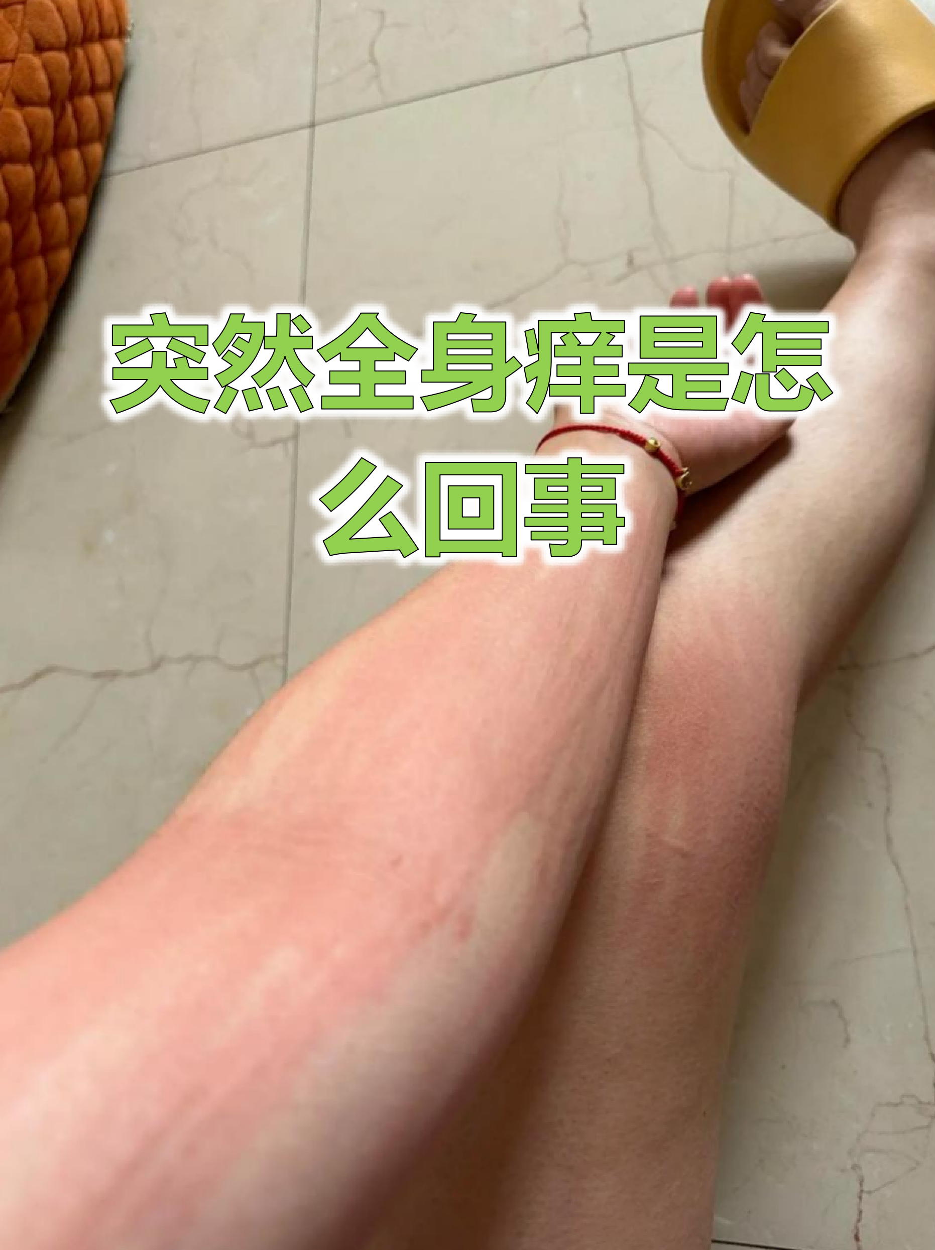 为什么会突然过敏了为什么在线