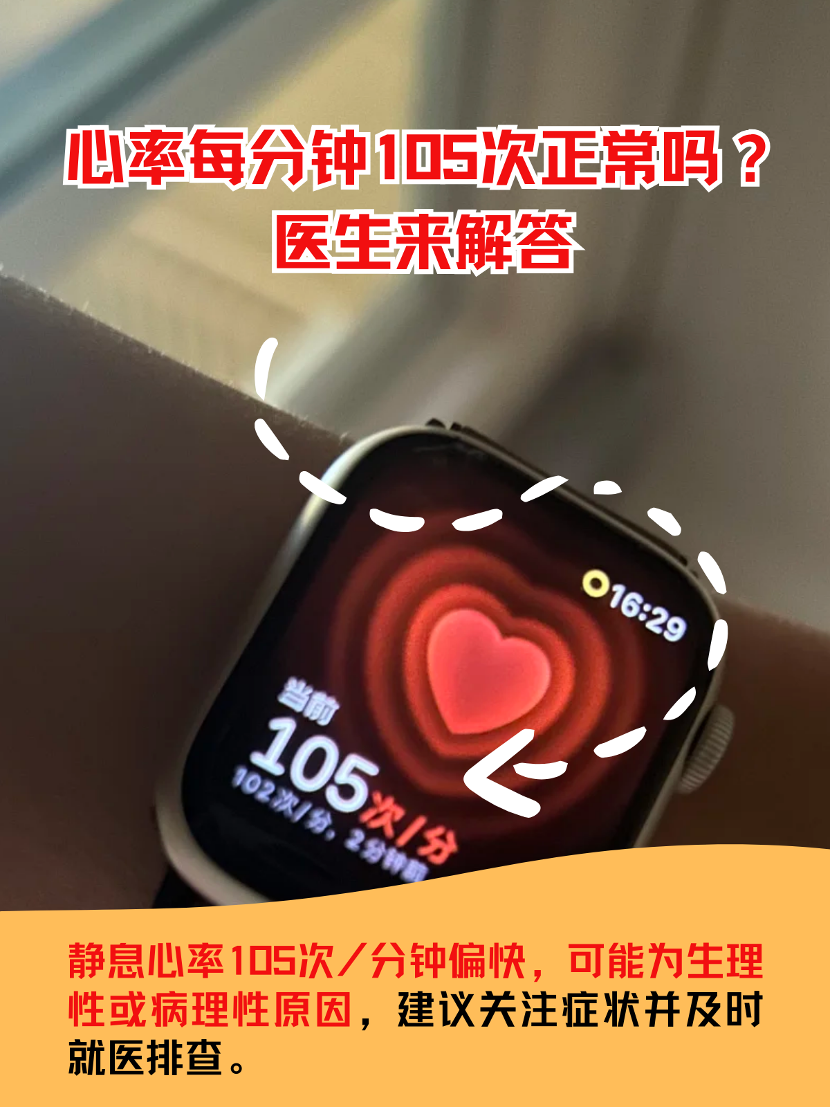 医生来解答 心率每分钟105次是否正常,需结合具体状态来判断