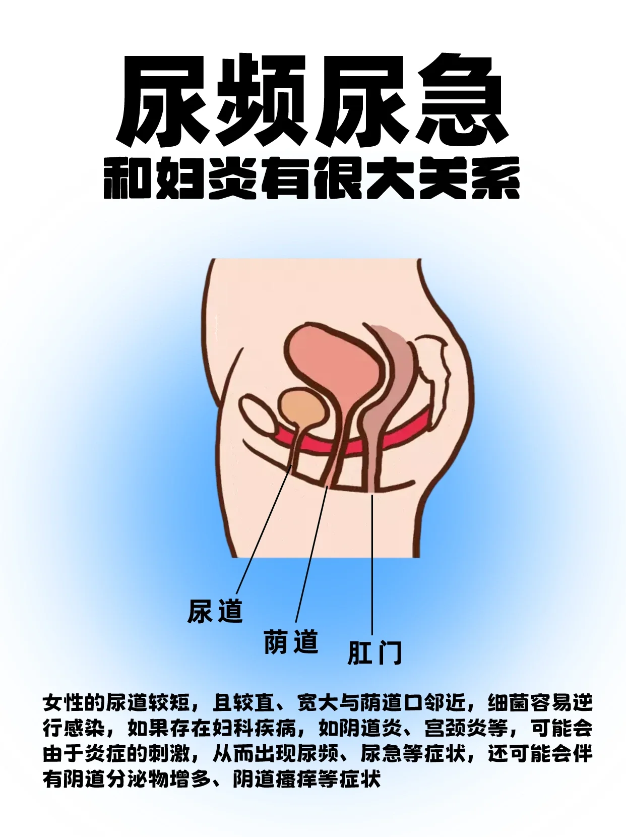 尿频尿急其实和妇炎有很大关系 尿频是指排06尿频率明显>正常值